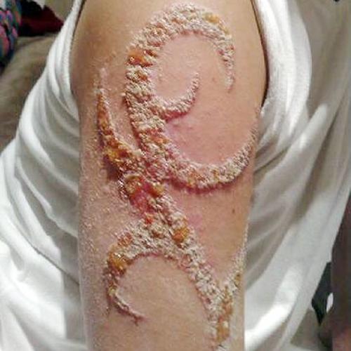 How to avoid tattoo infection proper aftercare design, idea 11