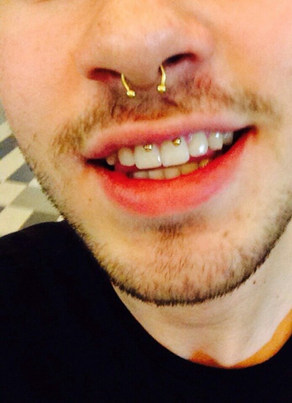 Smiley piercing 44 peeps who are rocking their smile tips design, idea 29