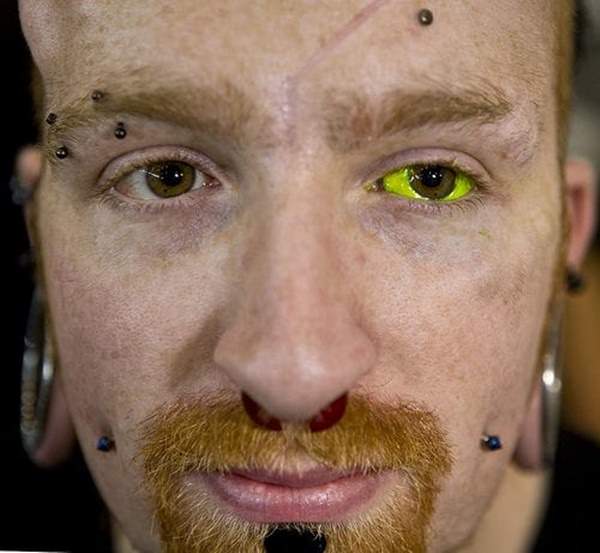 Polish model ends up blind in one eye after botched eyeball tattoo procedure