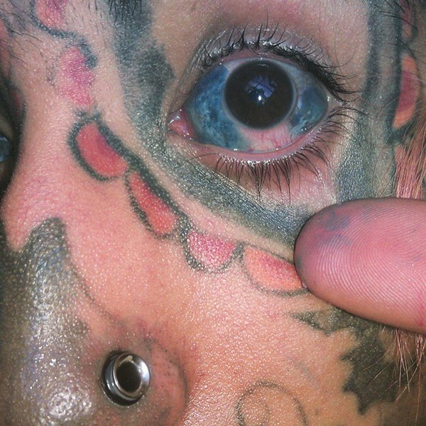 Eyeball Tattoo Leaves Model In Pain And Partially Blind